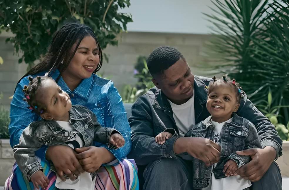 Abu Dhabi achieves historic separation of Nigerian conjoined twins